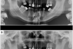 2021 09 21 22 55 1129 2021 09 22 X Ray Mask 20210921221647