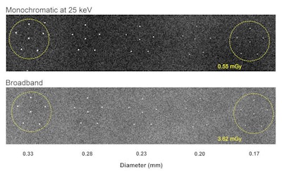 Sparkling images of microcalcifications embedded at the top of a 4.1-cm thick breast phantom acquired at a radiation dose of 0.55 mGy (top) compared with imaging obtained with a broadband mammography system at 3.62 mGy (bottom). Image courtesy of Eric Silver, PhD.