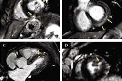 2021 09 22 23 22 1728 2021 09 23 Mri High Resolution Hearts 400