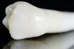 2021 09 23 18 23 9271 Tooth Maxillary Premolar 400