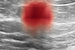 2021 09 24 15 57 9590 2021 09 24 Ai Breast Ultrasound Clinical Image 20210924153049