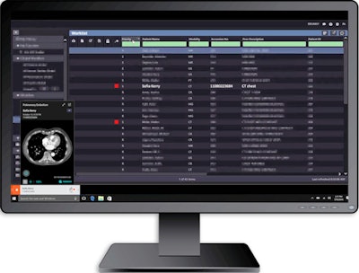 AI computer-assisted triage software for incidental detection of pulmonary embolism on CT. Image courtesy of Aidoc.