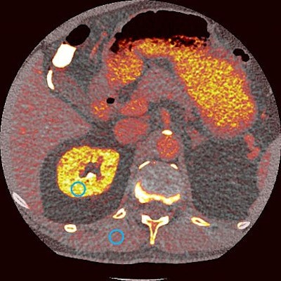 Photon-counting CT scan. Image courtesy of the U.S. National Institutes of Health.