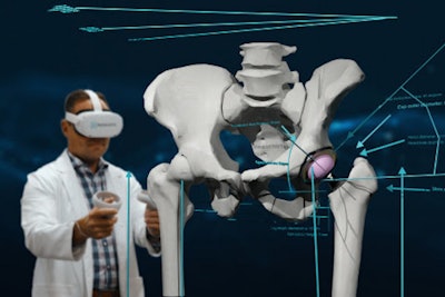 Kinomatic's new virtual reality platform enables orthopedic surgeons to develop surgical plans using patient-specific 3D models generated from CT scans. Image courtesy of Kinomatic.