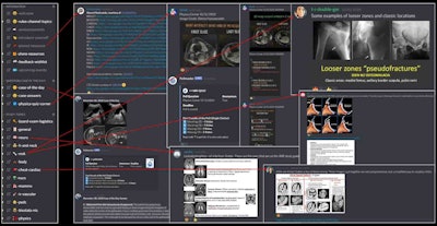 RadDiscord educational content created by radiology residents. Image courtesy of Dr. Grace Zhu.