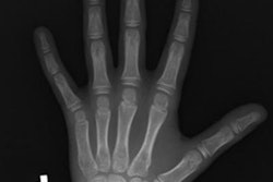 2021 09 28 23 16 4714 2021 09 29 Skeletal Age 20210928234518