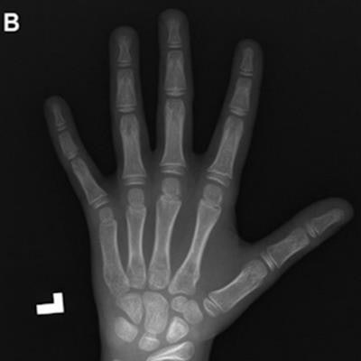 right hand x ray anatomy