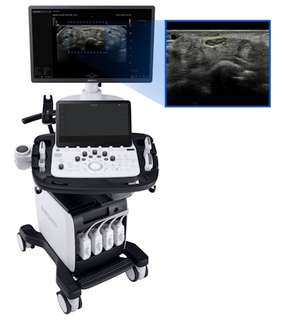 Image caption and attribution: Medison's V8 scanner is expected to include NerveTrack software that automatically tracks the nerve's location on the wrist in real-time. Image courtesy of Samsung Medison.