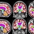2021 09 27 18 08 4585 2021 09 29 Minnies Best Radiology Image Ai Of Mri