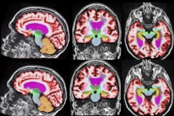 2021 09 27 18 08 4585 2021 09 29 Minnies Best Radiology Image Ai Of Mri