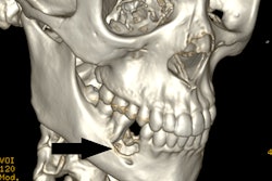 2021 10 01 23 16 8947 2021 10 04 Granuloma3 20211001231943
