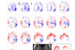 2021 10 04 18 24 9374 2021 10 05 Spect Brain Perfusion 20211004184910