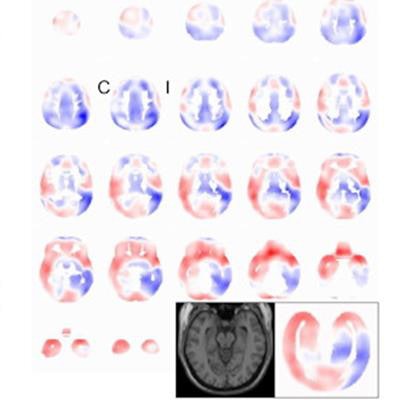 2021 10 04 18 24 9374 2021 10 05 Spect Brain Perfusion 20211004184910