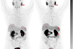 2021 10 07 17 00 7379 2021 10 08 Psma Tracer Uptake