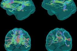 2021 10 11 20 15 1702 2021 10 12 Mri Brain With Notes 400