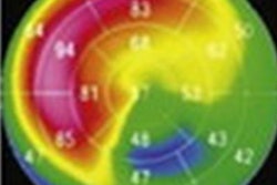 2021 10 15 22 21 1546 2021 10 18 Spect Heart 20211015224654
