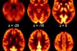 2021 10 19 16 47 1830 2021 10 20 Long Covid 19 Pet 20211019163307