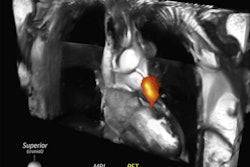 2021 10 20 18 19 8816 2021 10 21 Fibrin Tracer 400