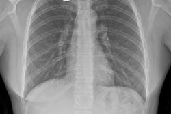 2021 10 28 19 04 4378 2021 10 28 Neurologica Anld 20211028191146