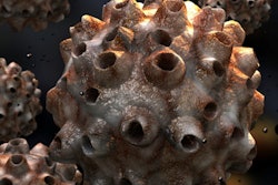 2021 10 28 17 23 4001 Hpv 400