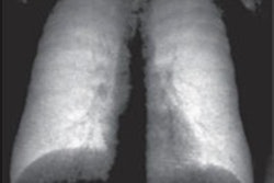 2021 11 01 22 52 8942 2021 11 03 Dark Field X Ray Schematic 20211101224952