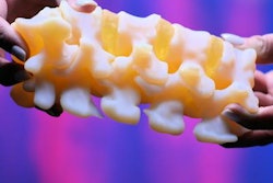 2021 11 02 17 45 0220 2021 11 02 Spine Model 20211102172020