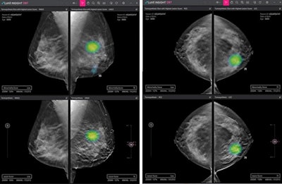 Lunit is launching its Lunit Insight DBT software at RSNA 2021. Image courtesy of Lunit.