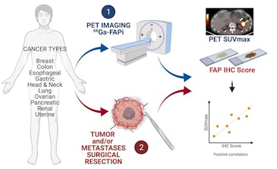 Image courtesy of the Journal of Nuclear Medicine.