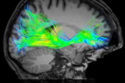 2021 11 16 22 54 9437 2021 11 17 Brainance Fda 400