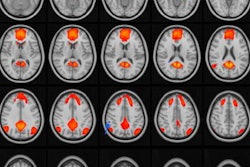 2021 11 19 02 30 3311 2021 11 22 Rsna Concussions Johnson 20211119020446
