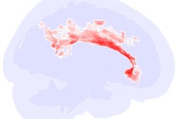 2021 11 19 17 00 3081 2021 11 23 Rsna Autism Weber 20211119172037