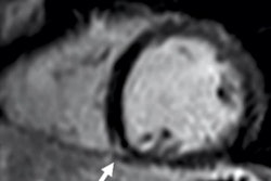 2021 11 23 18 15 5816 2021 11 29 Cardiac Mri Rsna