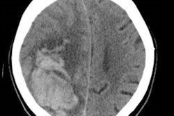 2021 11 23 23 32 4846 2021 11 30 Rsna Blood Thinner 400