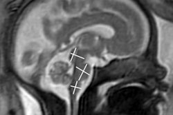 2021 11 29 00 34 7243 2021 11 30 Rsna Fetal Brain Mri 20211129002043