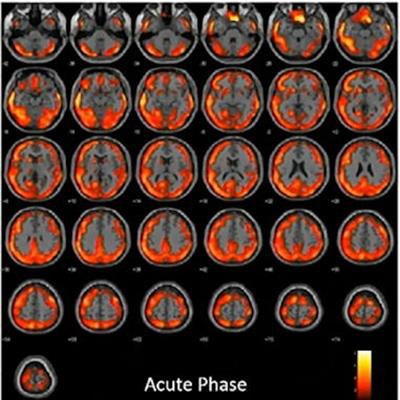 2021 11 29 21 53 4651 2021 11 29 Neuro Covid 19 20211129215009