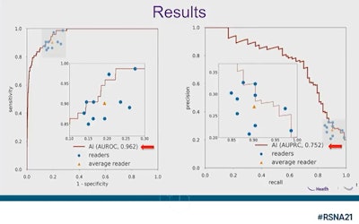 An AI model trained by New York University researchers proved to be superior in reading breast ultrasound images over board-certified radiologists, with researchers saying it could help with radiologist workloads and recommend fewer biopsies. Image courtesy of Dr. Linda Moy.