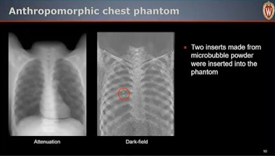 Image courtesy of Ran Zhang, PhD.