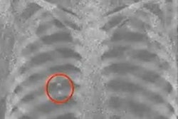 2021 11 30 17 25 6743 2021 11 30 Rsna Phantom X Ray 20211130171130