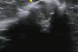 2021 11 30 17 56 0838 2021 11 30 Rsna Lymph Node Ceus 20211130175239