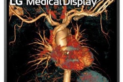 2021 11 30 21 55 6915 2021 11 30 Lg Display 20211130215928