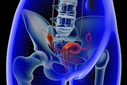 2017 08 25 13 47 26 468 Uterus Pelvic 400
