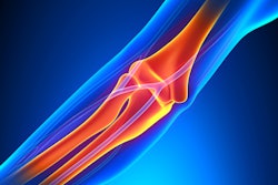 2018 01 03 23 08 3569 Elbow Joint 400