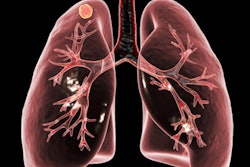 2021 01 19 17 46 9472 Lung Tuberculosis Art 400