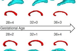 2021 11 22 18 41 7801 2021 12 01 Rsna Fetal Alcohol 20211122180713