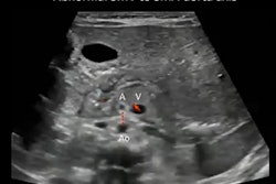 2021 12 01 17 27 7195 2021 12 01 Rsna Malrotation 400