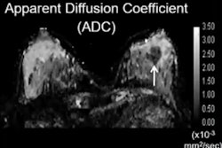 2021 12 01 21 28 0723 2021 12 01 Rsna Diffusion Weighted Imaging 400