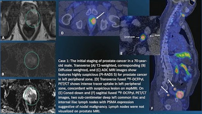 Image courtesy of Dr. Soheil Kooraki.
