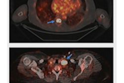 2021 12 03 02 06 9186 2021 12 03 Pet Sclc 400