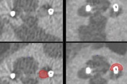 2021 12 07 00 18 5352 2021 12 07 Ct Cochlear Figure4 20211207003710