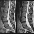 2021 12 07 16 11 7602 2021 12 06 Spine Ai 20211207163009